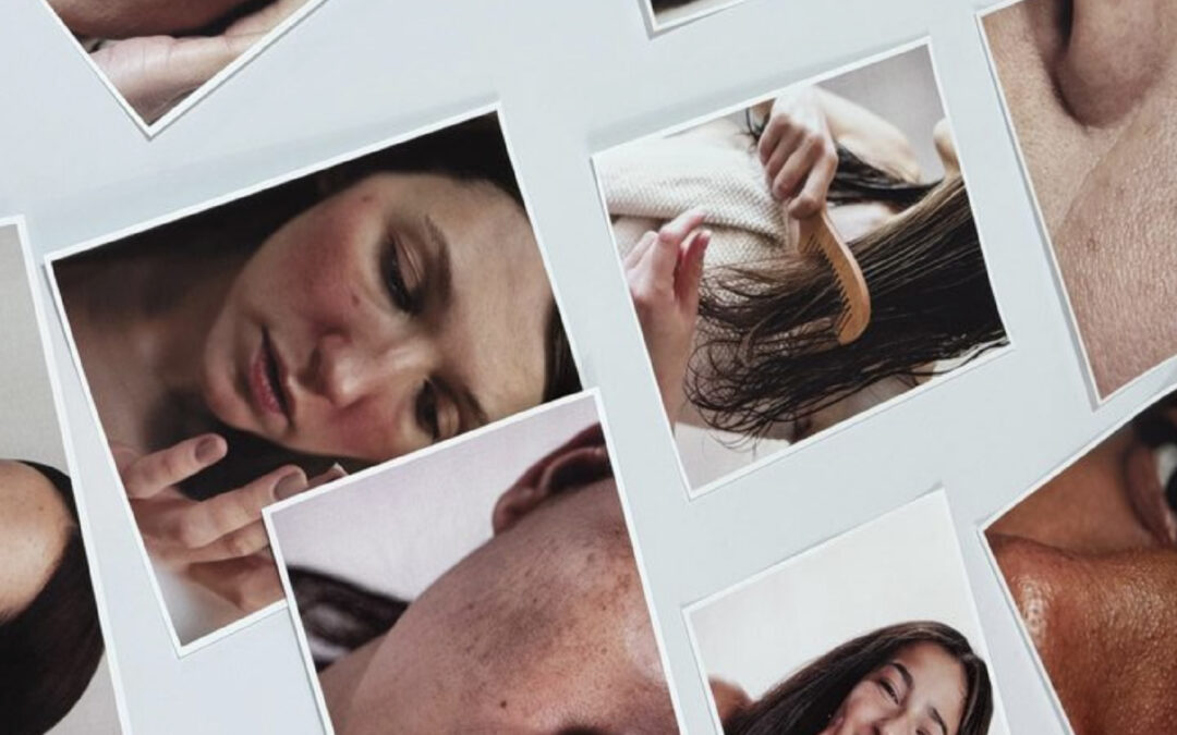 Poros abiertos: guía sencilla para reducir su apariencia