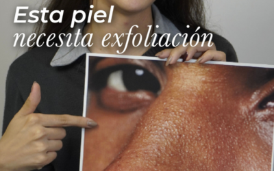¿Tu piel se ve apagada o con textura? Tu piel necesita exfoliación