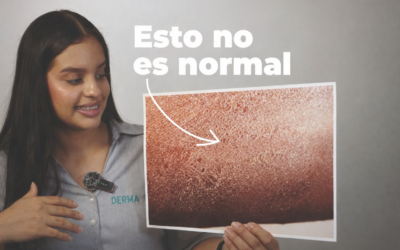 sequedad en la piel: señales, causas y cómo tratarla